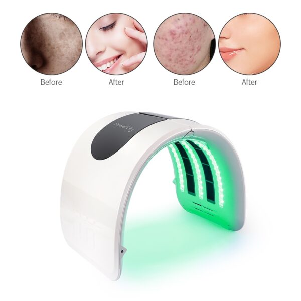 Home Light Beauty Instrument