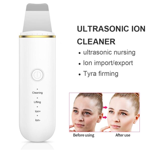Ultrasonic Facial Skin Cleansing Device
