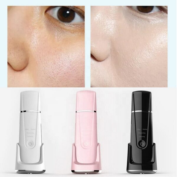 Facial Blackhead Remover