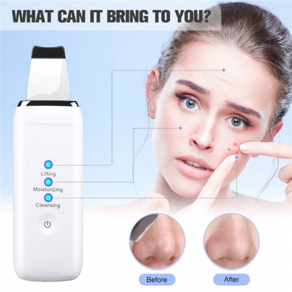 Ultrasonic Skin Scrubber Scraper