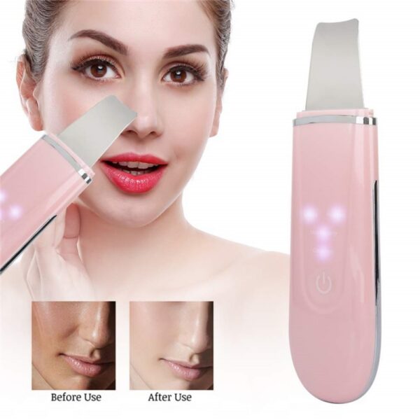 Ultrasound Skin Scrubber Face Spatula